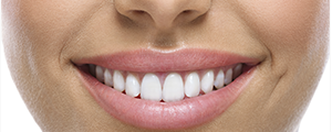 Women's mouth smiling with lovely white teeth